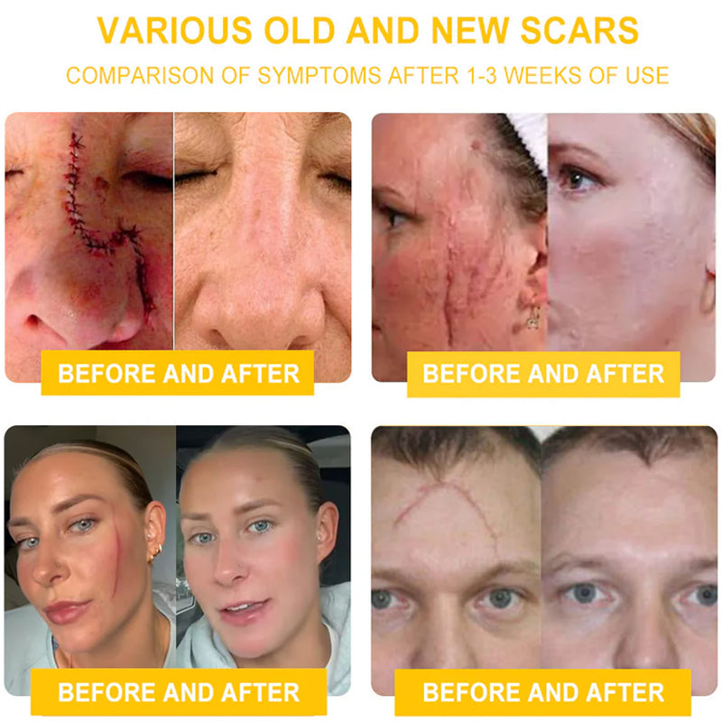 BeeLuxe™ Bee Venom Skin Cream