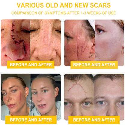 BeeLuxe™ Bee Venom Skin Cream