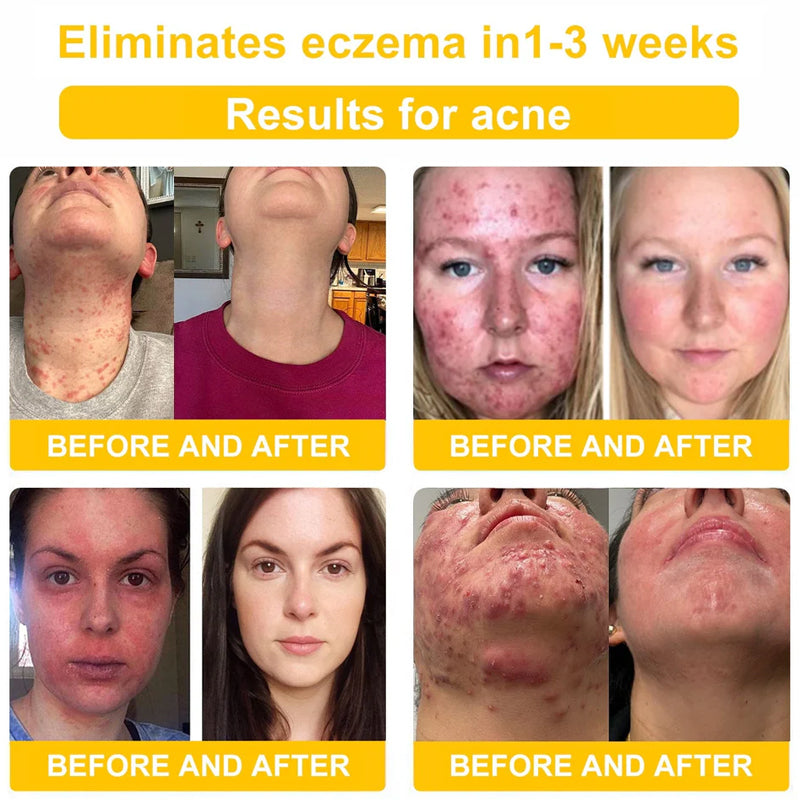 BeeLuxe™ Bee Venom Skin Cream