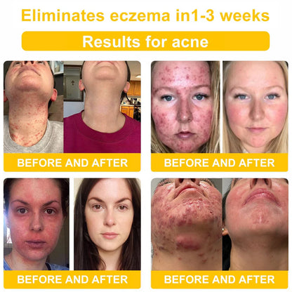 BeeLuxe™ Bee Venom Skin Cream