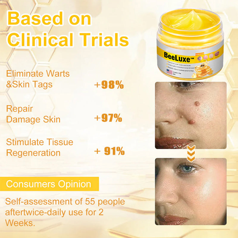 BeeLuxe™ Bee Venom Skin Cream