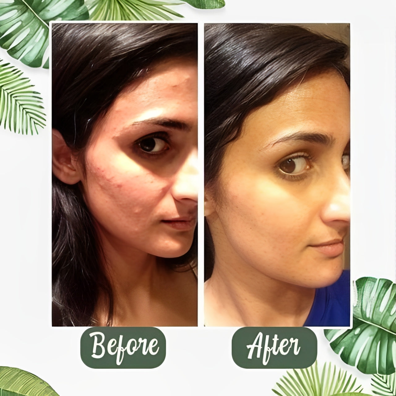Deep Cleansing  Green Tea Mask.