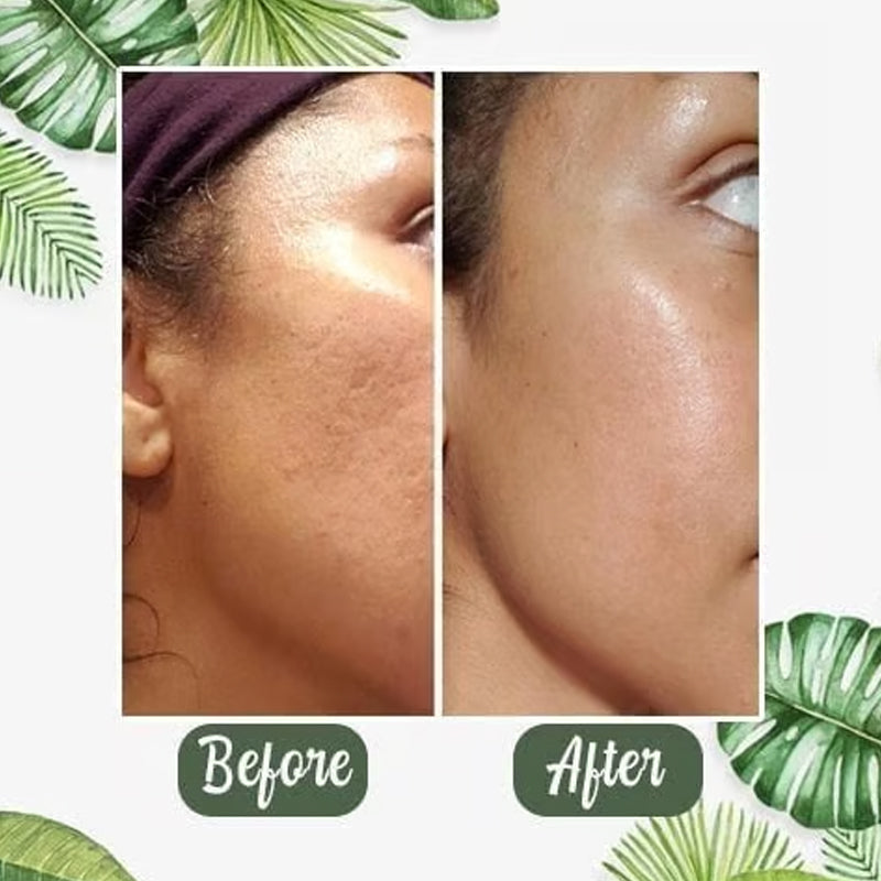 Deep Cleansing  Green Tea Mask.