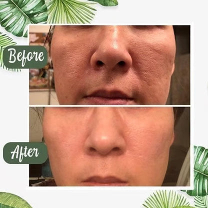 Deep Cleanse Green Tea Mask!
