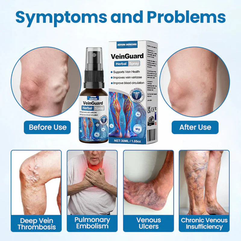 VeinGuard Herbal Spray